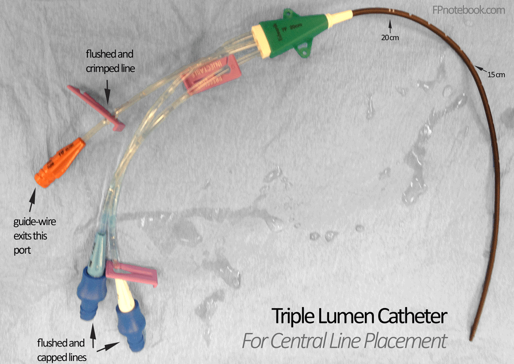 کاتتر وریدی تریپل لومن Triple Lumen Catheter