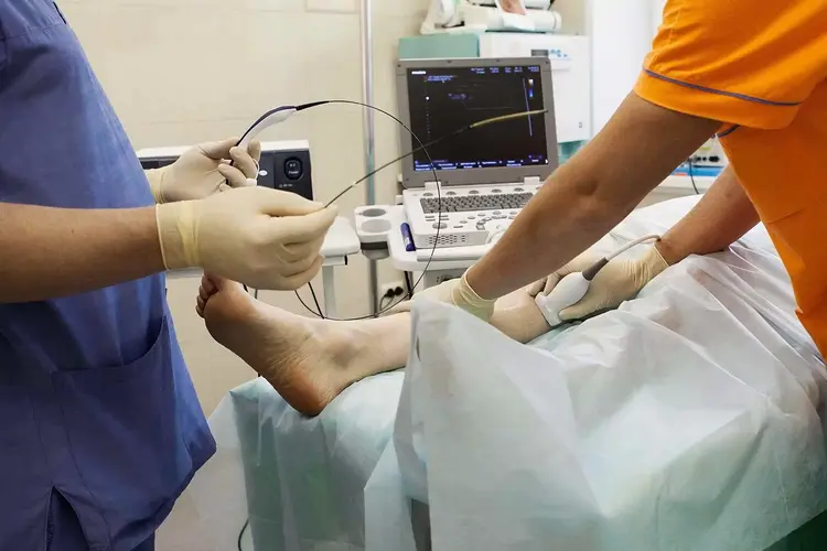 درمان واریس با لیزر (RF) Treatment of Varicose Veins with Radiofrequency Ablation