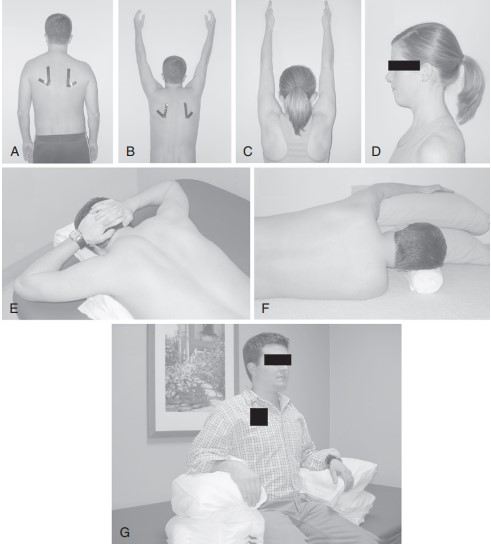 درمان سندورم TOS نوروژنیک با فیزیوتراپی Treatment of Neurogenic TOS with Physiotherapy