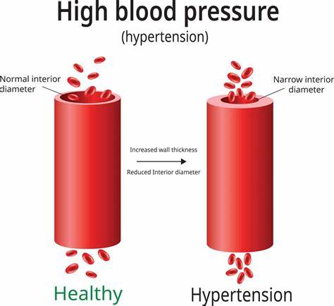 The Effects of Hypertension on Arterial Integrity