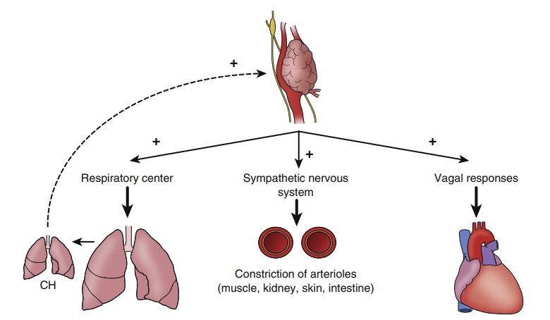 مکانیسم ایجاد تومور جسم کاروتید Mechanism of creating carotid body tumor