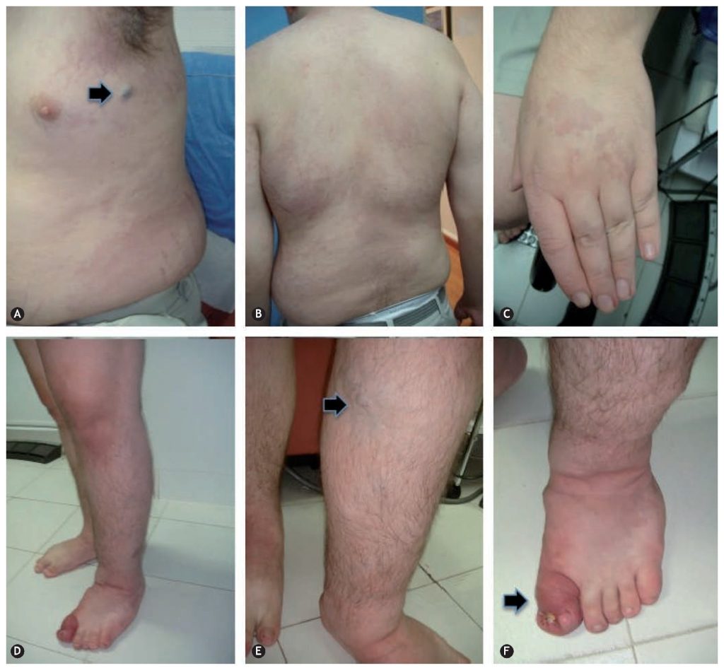 دکتر مقداد قاسمی گرجی جراح عروق ایران